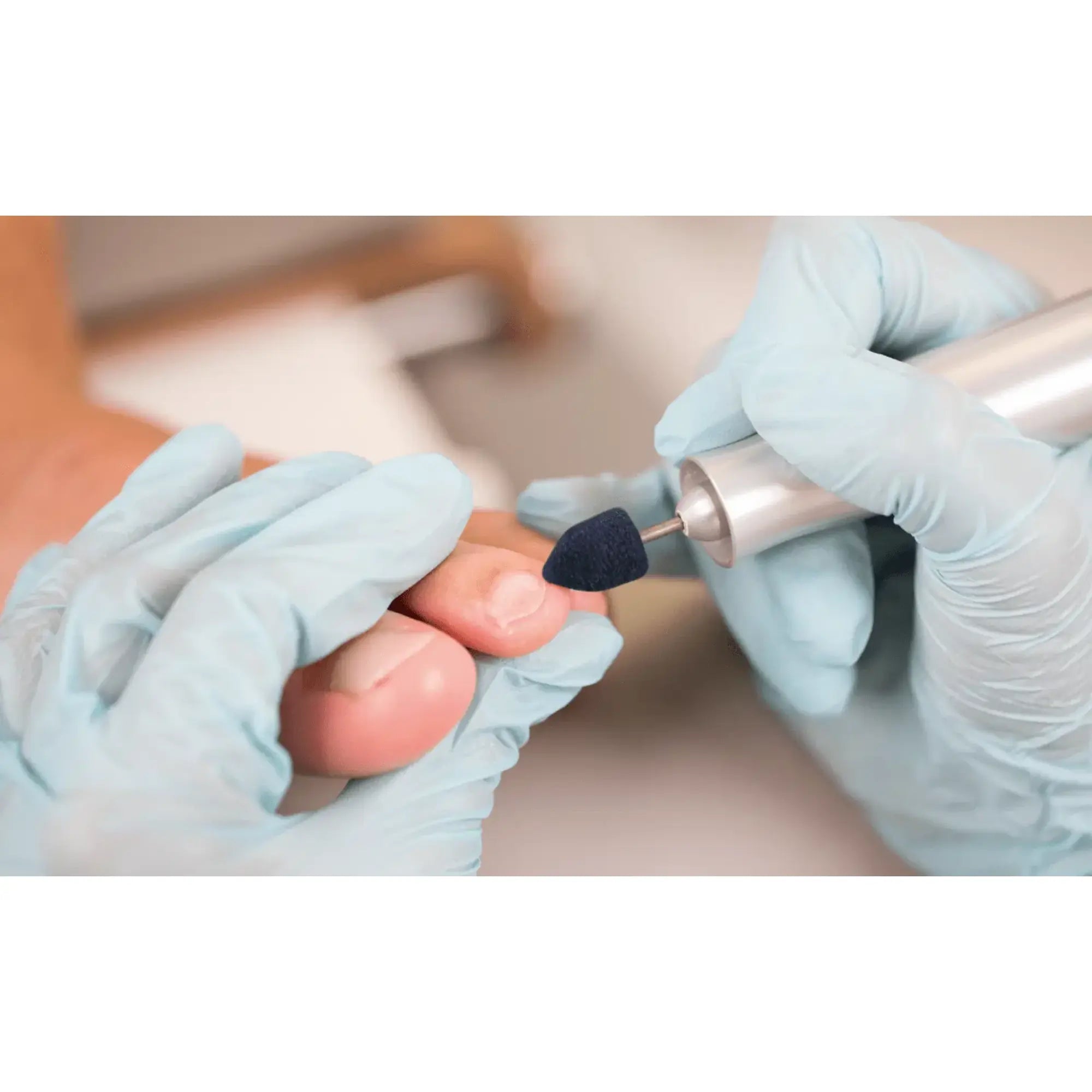 Capuchons abrasifs pointus x10 1003 - Diamant - Grain gros - Abrasion des cors, durillons et hyperkératoses - 10 mm Ruck