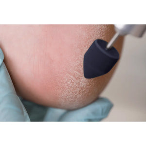 Capuchons abrasifs pointus x10 1102 - Diamant - Grain moyen - Abrasion des cors, durillons et hyperkératoses - 13 mm Ruck