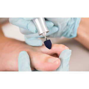 Capuchons abrasifs pointus x10 1102 - Diamant - Grain moyen - Abrasion des cors, durillons et hyperkératoses - 13 mm Ruck