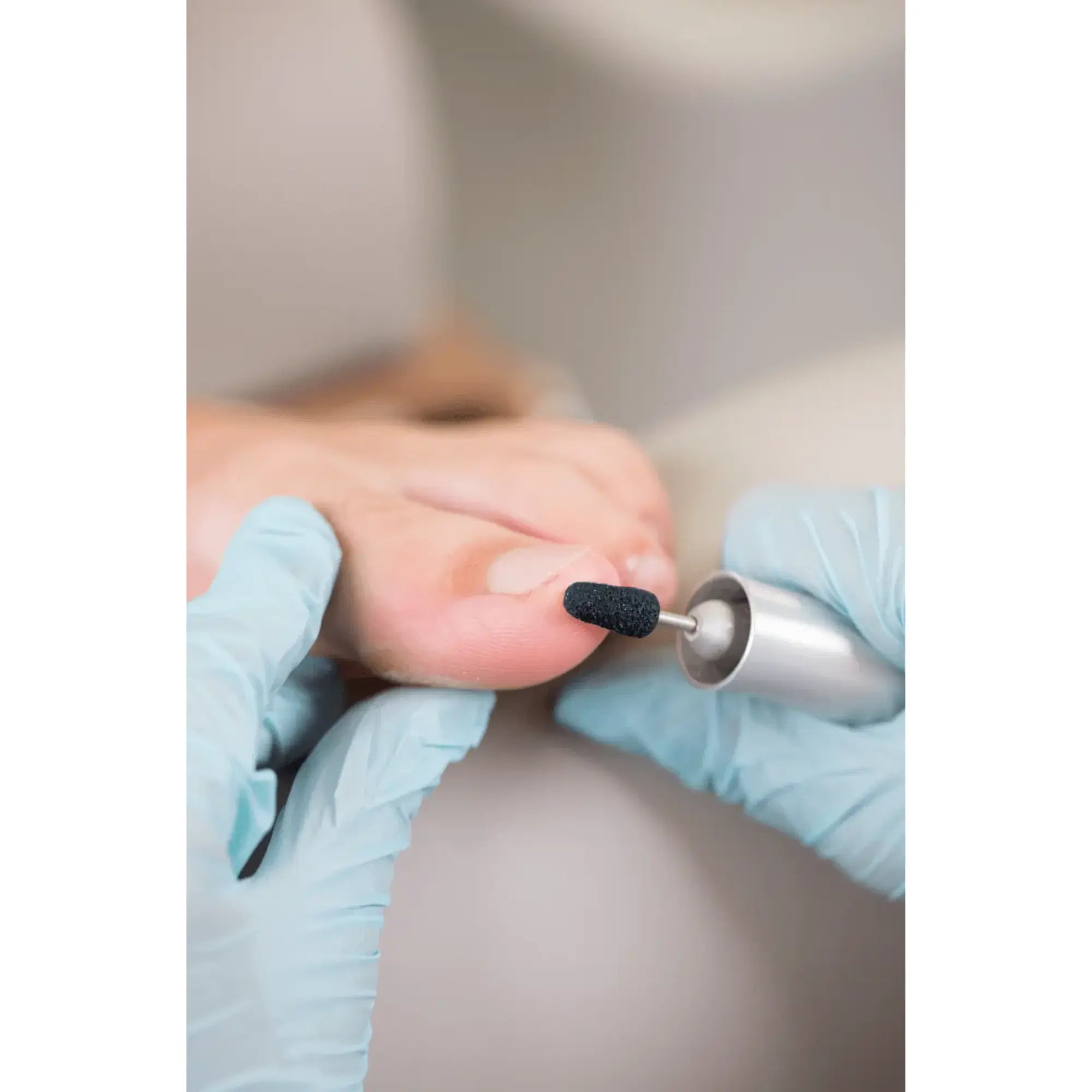 Capuchons abrasifs ronds x10 0901 - Diamant - Grain fin - Abrasion des cors, durillons et hyperkératoses - 16 mm Ruck