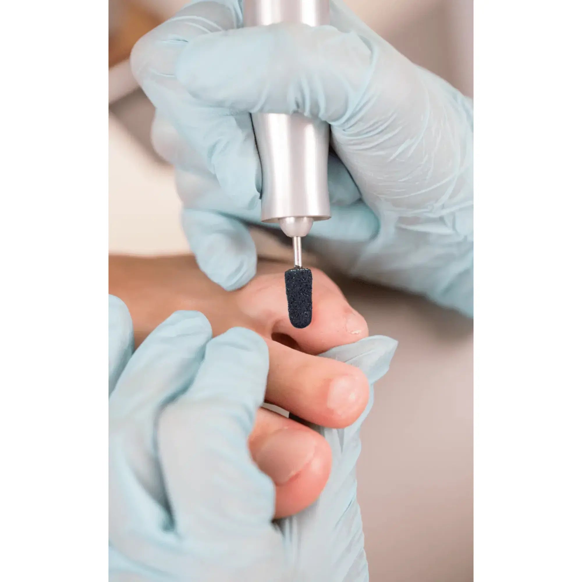 Capuchons abrasifs ronds x10 0902 - Diamant - Grain moyen - Abrasion des cors, durillons et hyperkératoses - 16 mm Ruck