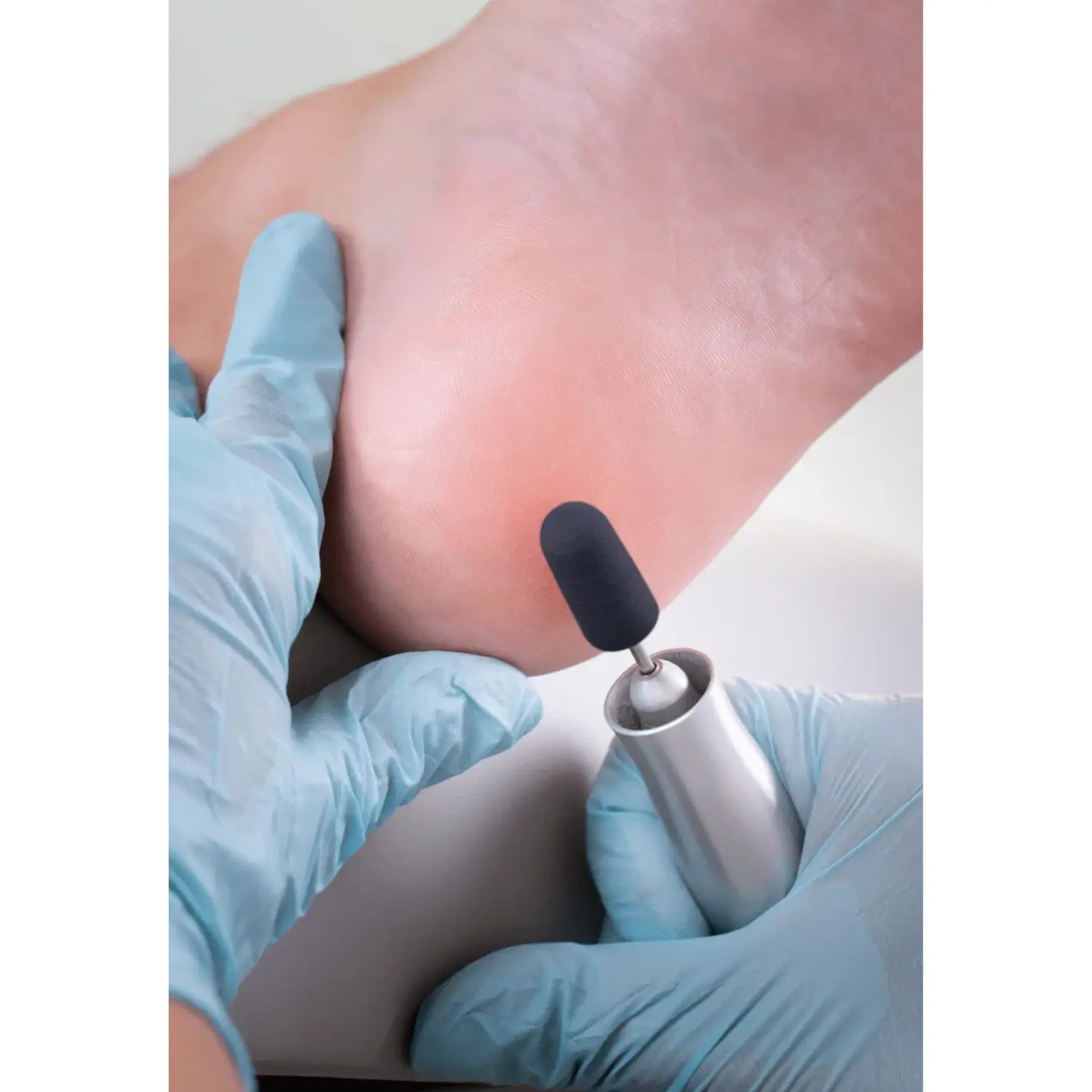 Capuchons abrasifs ronds x10 1301 - Diamant - Grain fin - Abrasion des cors, durillons et hyperkératoses - 5 mm Ruck