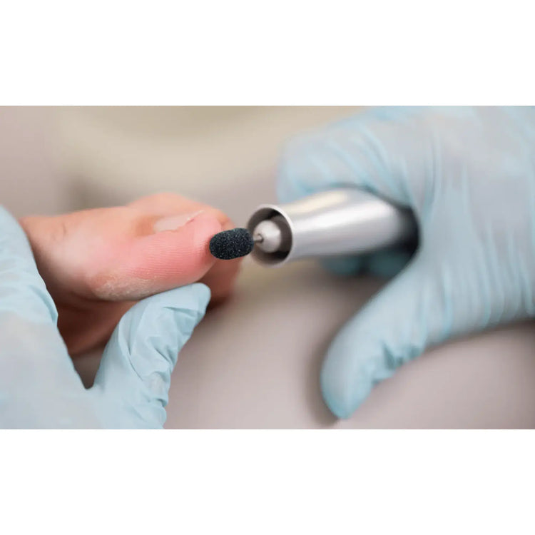 Capuchons abrasifs ronds x10 1303 - Diamant - Grain gros - Abrasion des cors, durillons et hyperkératoses - 5 mm Ruck