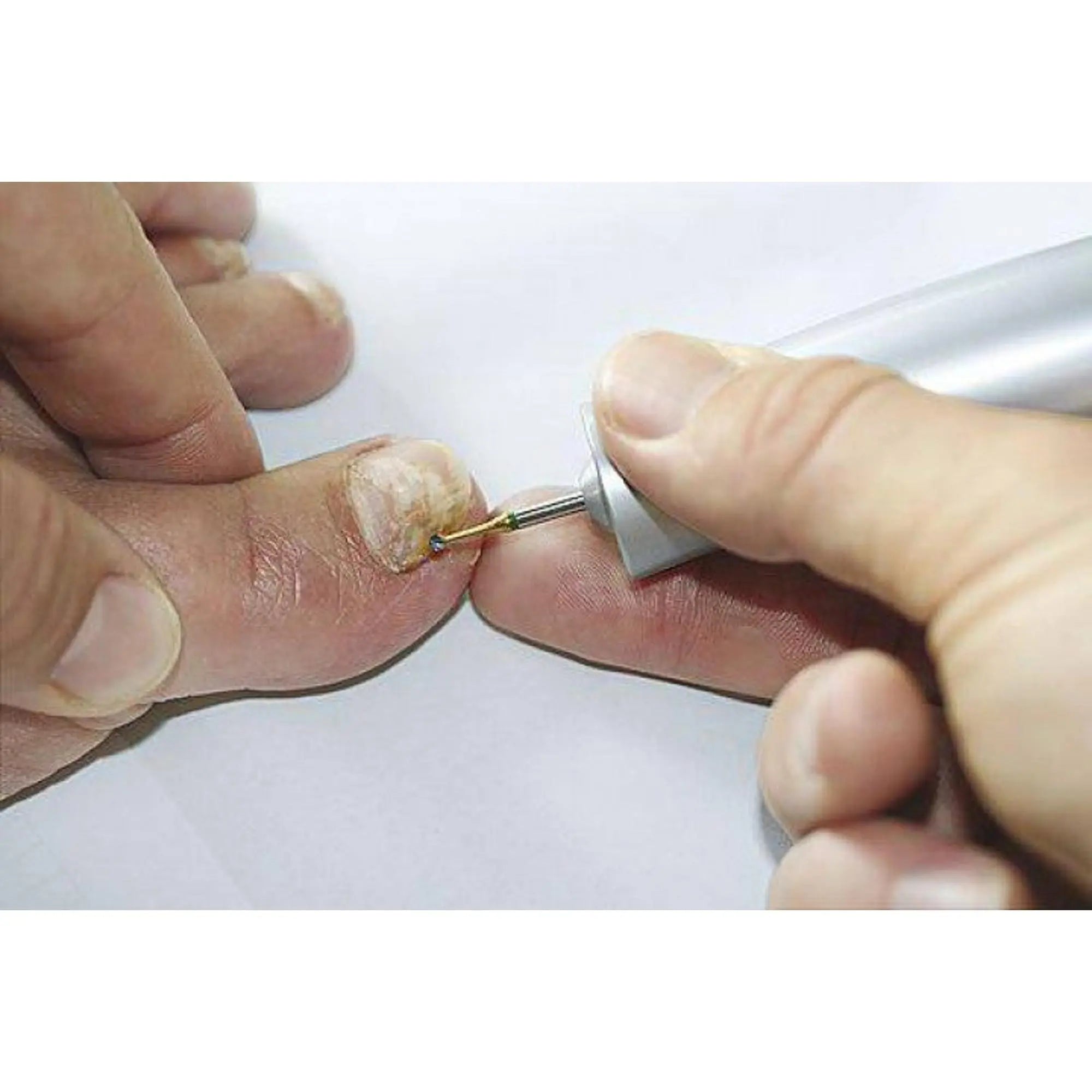 Fraise 1SXM Carbure de tungstène - Enucléation des cors - 2,3 mm - My Podologie