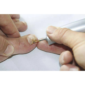 Fraise 1SXM Carbure de tungstène - Enucléation des cors - 2,3 mm - My Podologie