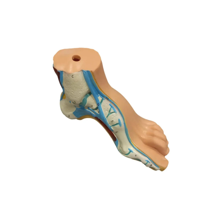 Modèle de pied creux - Herbitas Herbitas