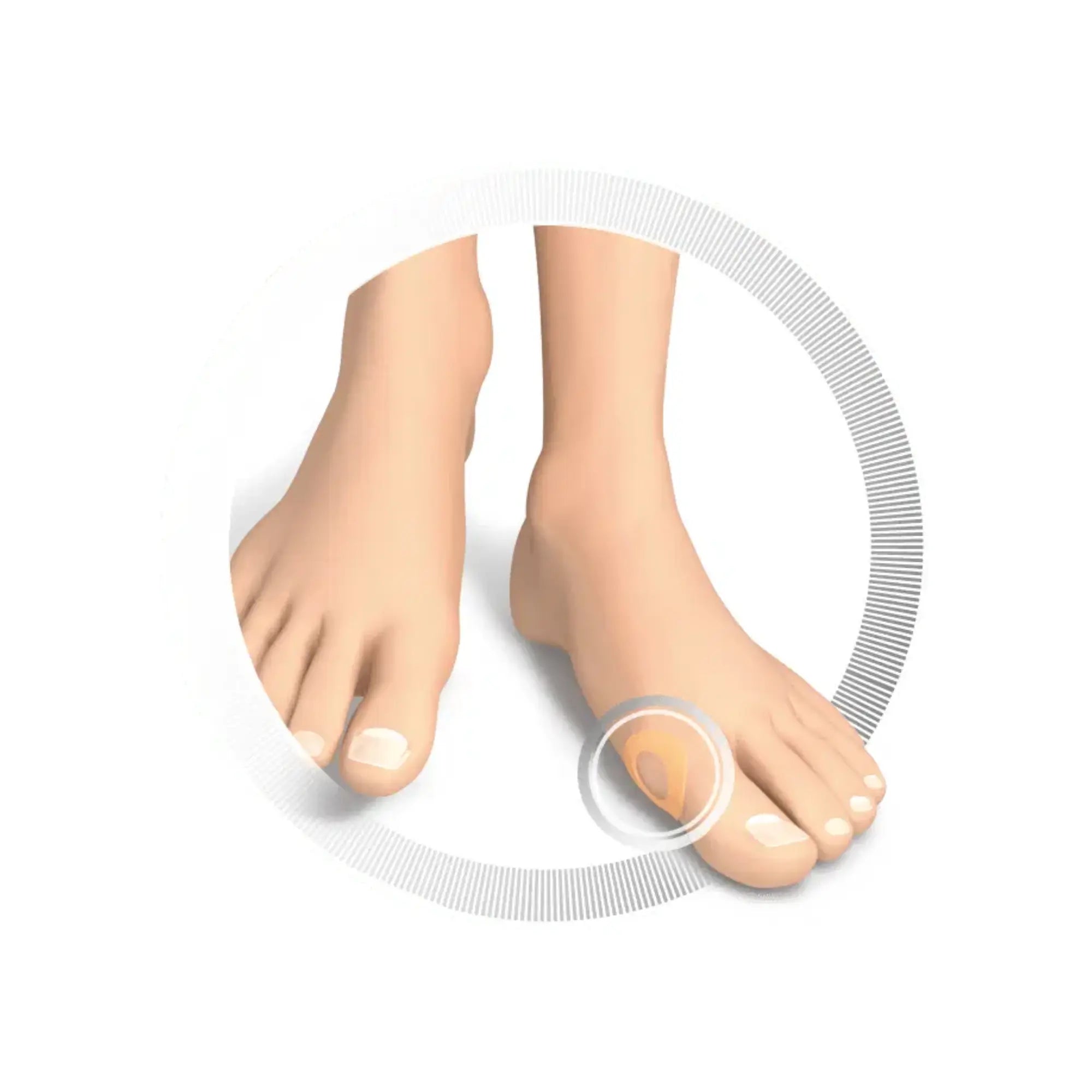 Protection pour Hallux - Anneaux de protection en silicone - Ruck Ruck