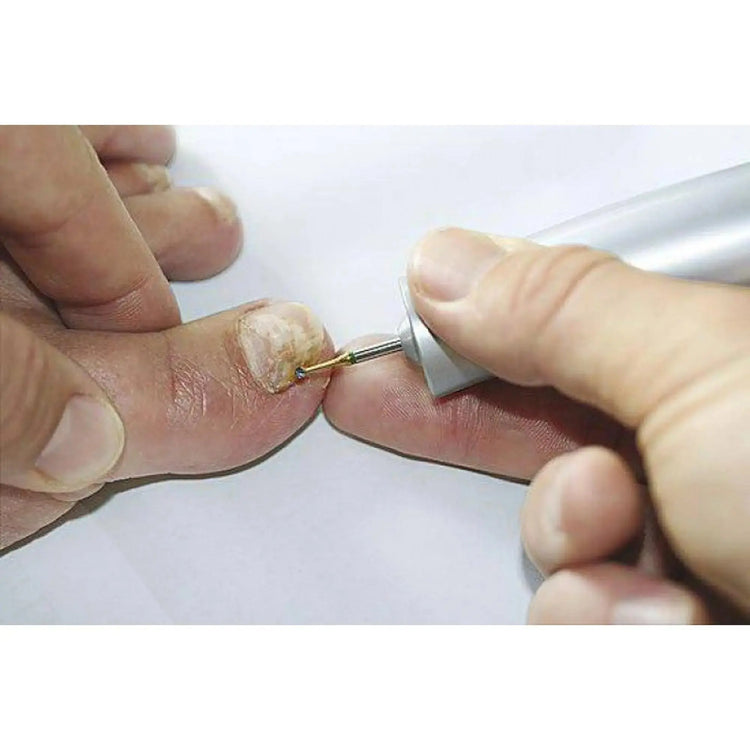 Fraise 1SXM Carbure de tungstène - Enucléation des cors - 2,1 mm - My Podologie