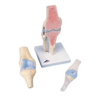 Modelo seccional de la articulación de la rodilla, en 3 partes - Anatomía y patología