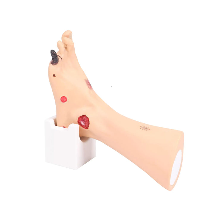 Modelo de pie con heridas - Anatomía y patología Mi Podología 