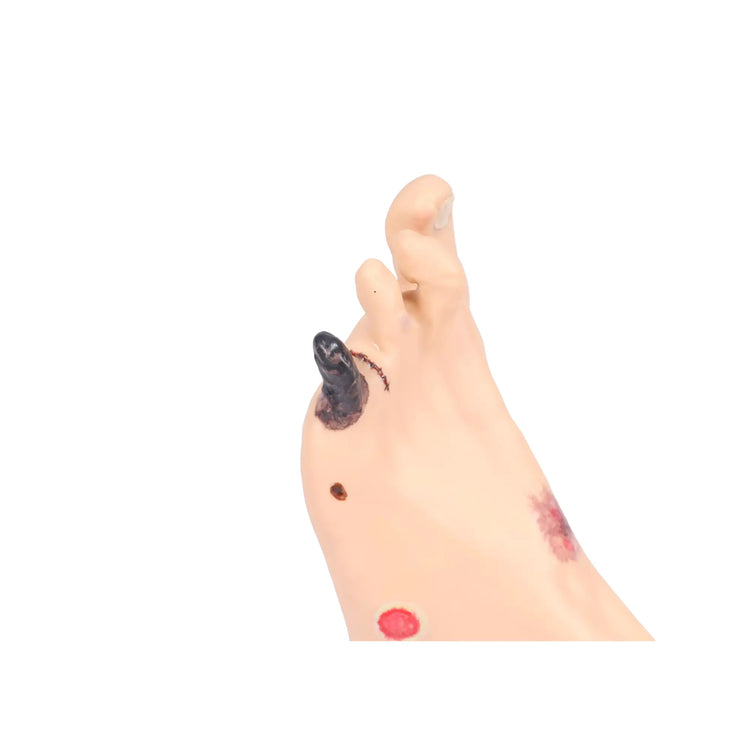 Modelo de pie con heridas - Anatomía y patología Mi Podología 