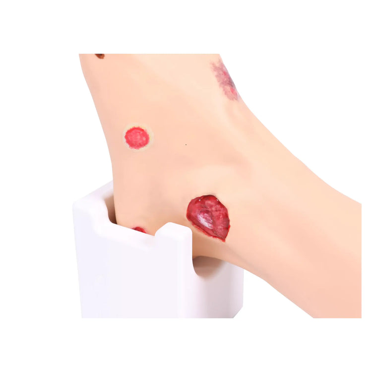 Modelo de pie con heridas - Anatomía y patología Mi Podología 