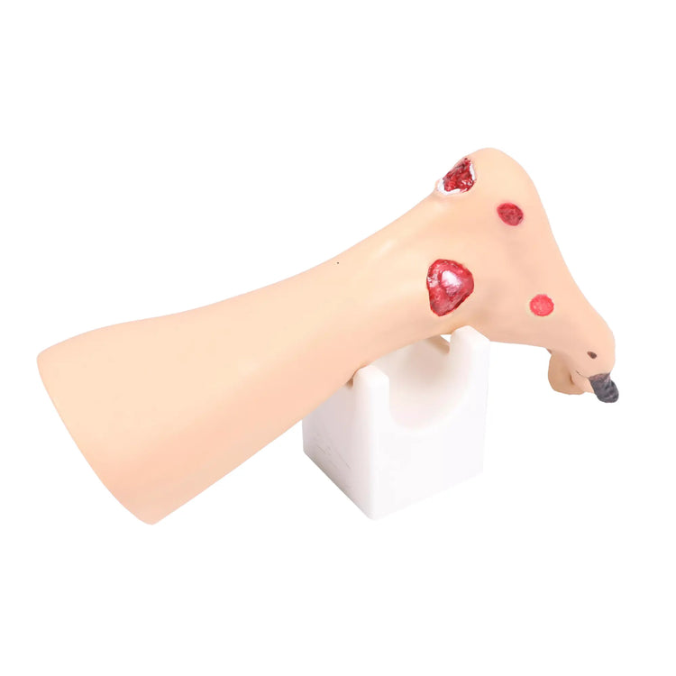 Modelo de pie con heridas - Anatomía y patología Mi Podología 