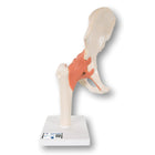 Modelo funcional de lujo de la articulación de la cadera: anatomía y patología