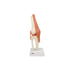 Modelo funcional de lujo de la articulación de la rodilla - Anatomía y patología